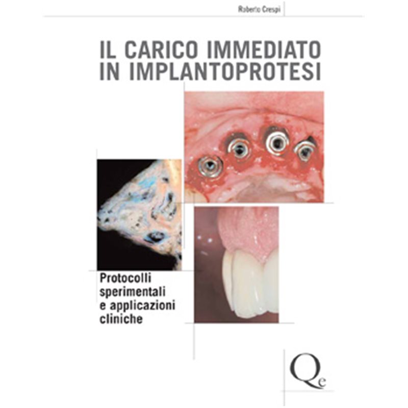 Il carico immediato in implantoprotesi + 3 grandi classici in omaggio